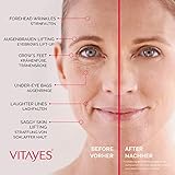 VITAYES Instant Ageback - Anti Aging Creme